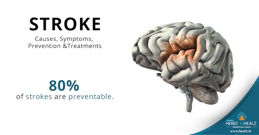 A stroke is when. The strokes is. Healz.